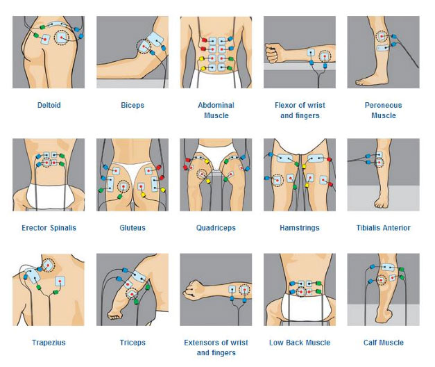 Electrodes EasySnap™ Compex pour électrostimulateur - Sport Orthèse