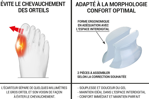 explication du fonctionnement des écarteurs Epitact