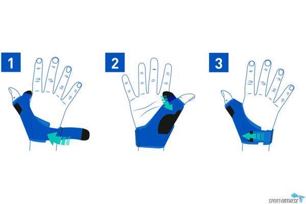 schéma de mise en place de l'attelle de pouce