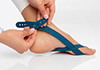 Mise en place Taping Hallufix pour Hallux Valgus 5