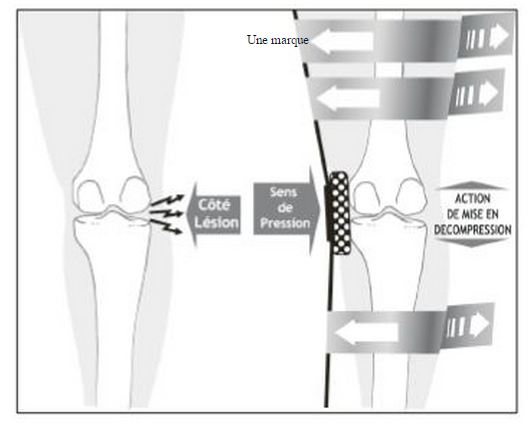 Genouillère gonarthrose Clima-Flex OA DONJOY