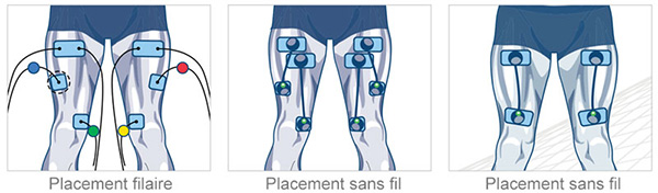 Électrodes et musculation : quels avantages et inconvénients ?