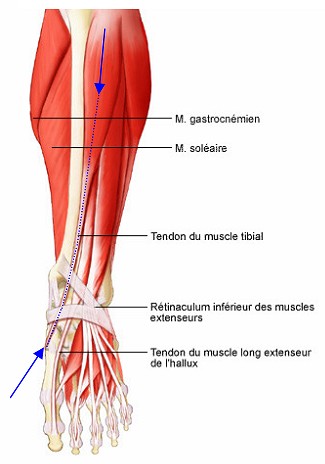 Tendinite du Releveur du Pied | Soigner vos douleurs sportives