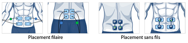 placements-electrodes-abdo-musculation