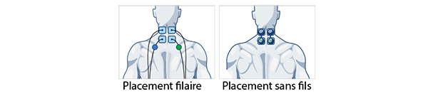 placements-electrodes-cou-ervicalgie