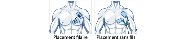 placements-electrodes-pectoraux-musculation