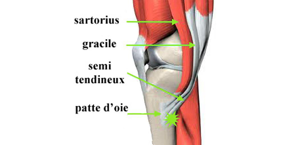 Tendinite Patte d Oie & Sport : Douleur Genoux Interne