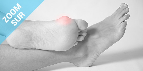 Zoom sur l'Hallux valgus